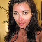 Kim Kardashian sunburn